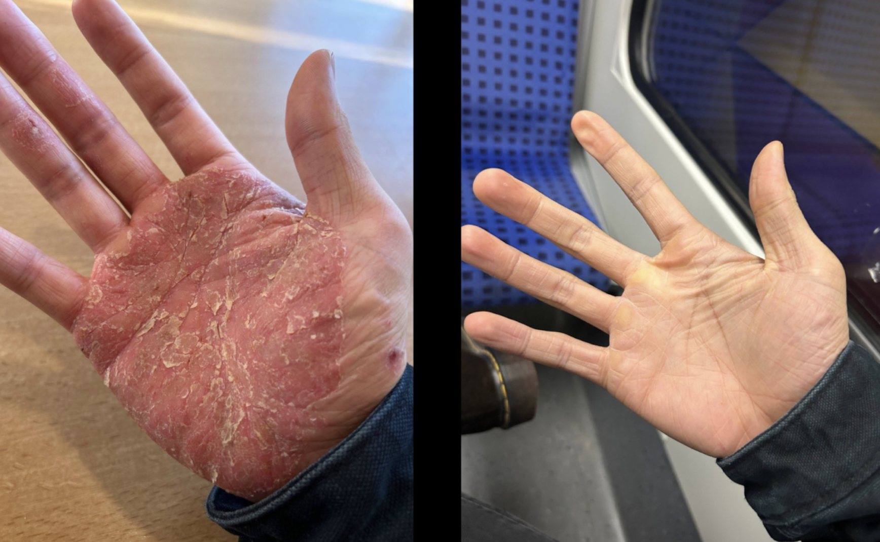 Darm, Immunsystem und Hautbild 3